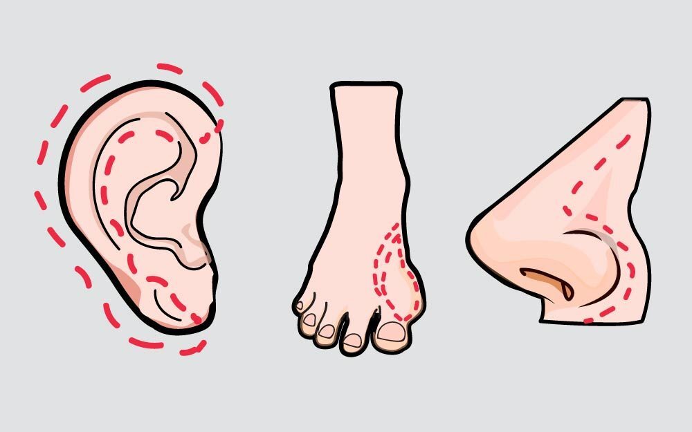 plastic-surgery-procedures-you-didnt-know-insurance-would-cover-ft2-1288834