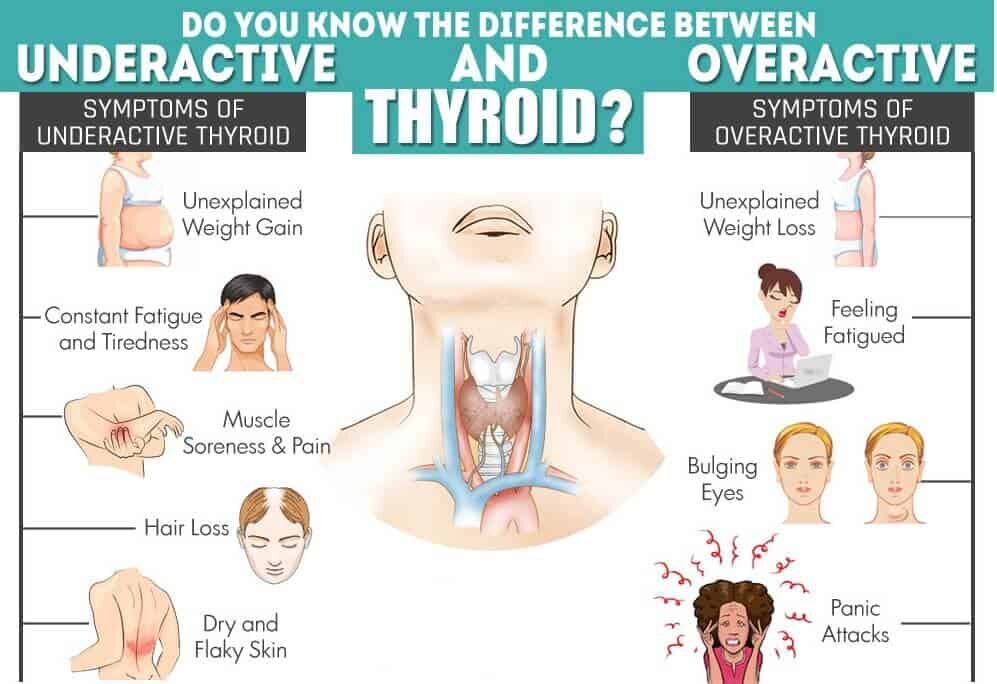 underactive-thyroid-6013410