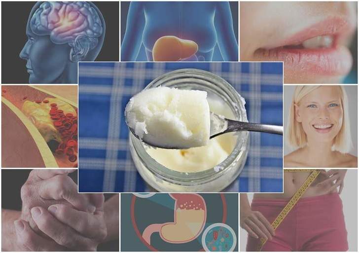 eat-coconut-oil-3-8213484