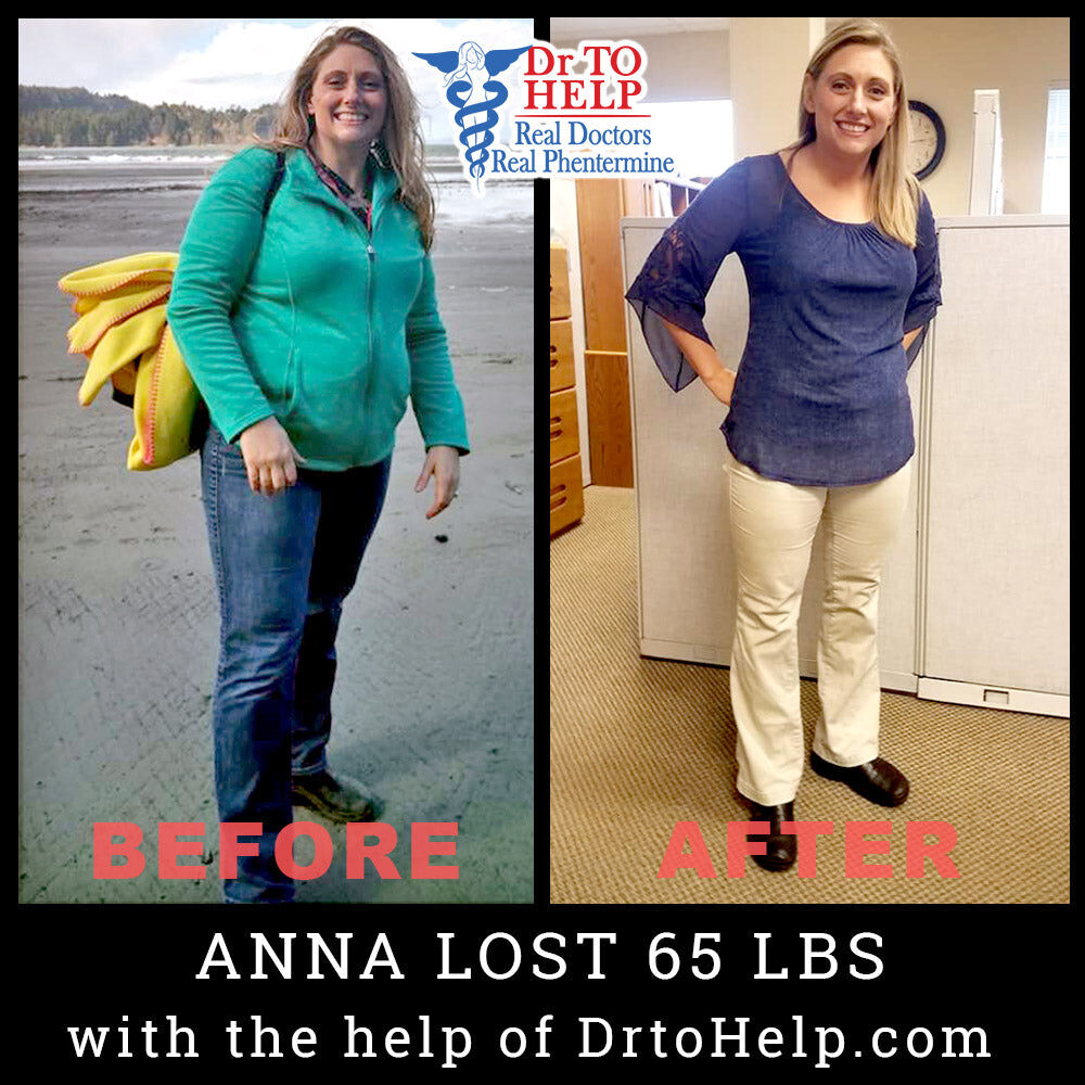 anna-before-after-2_3cbf3787-0f9a-4a3d-8bd2-1bc5938a4817-2178979