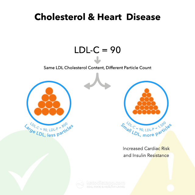 cholesterol-and-heart-disease-8757259