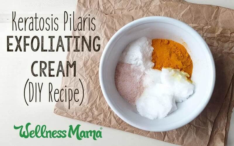 keratosis-pilaris-exfoliating-cream-diy-recipe-800x500-7922548