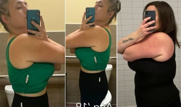 keto-weight-loss-reddit-user-transformation-pics-1179009-2802191