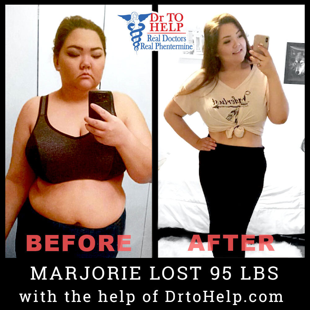 marjorie-before-after-4351810