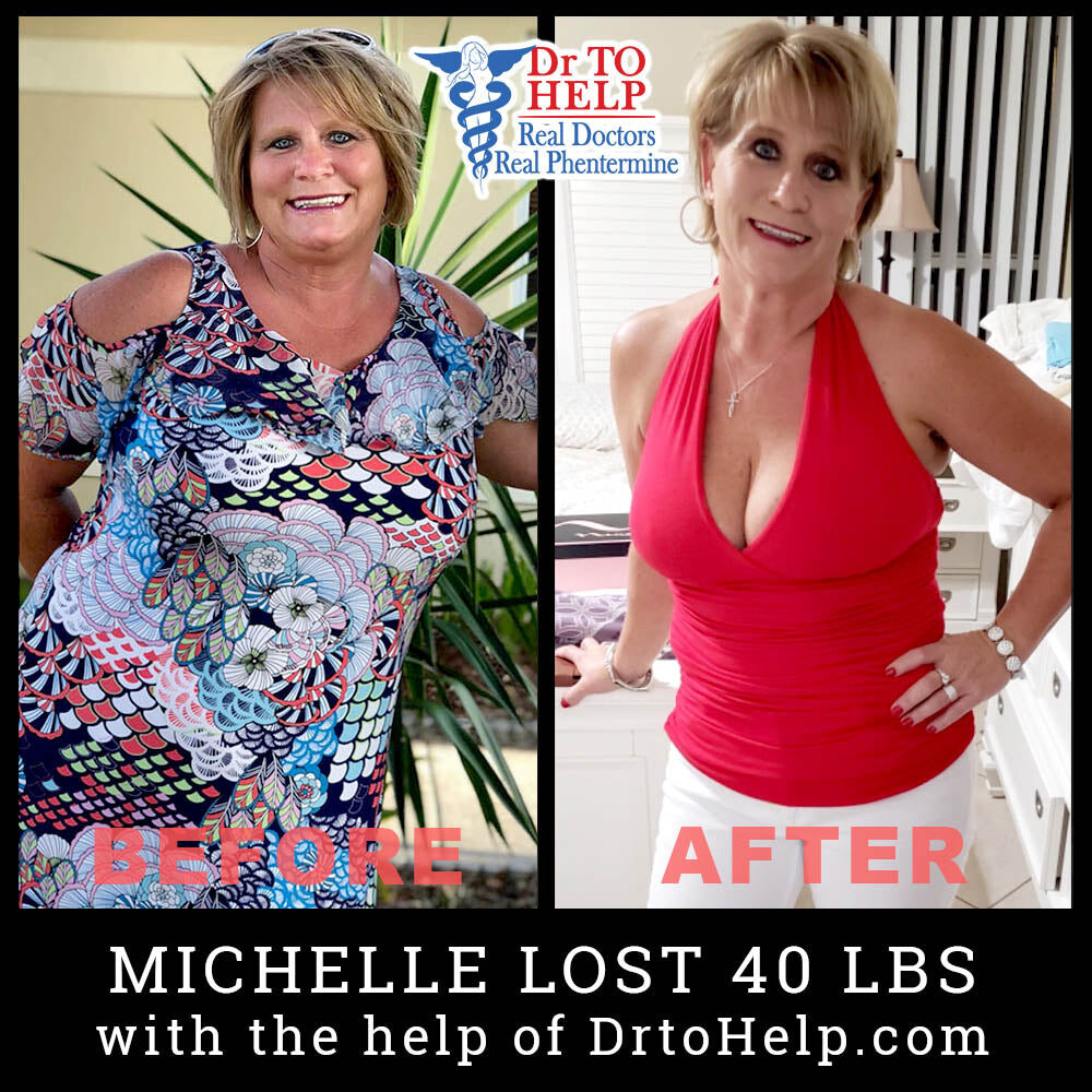 michelle-c-before-after-5001672