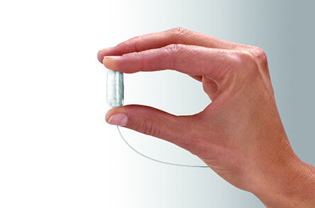 obalon-capsule-hand-450x298-9324354