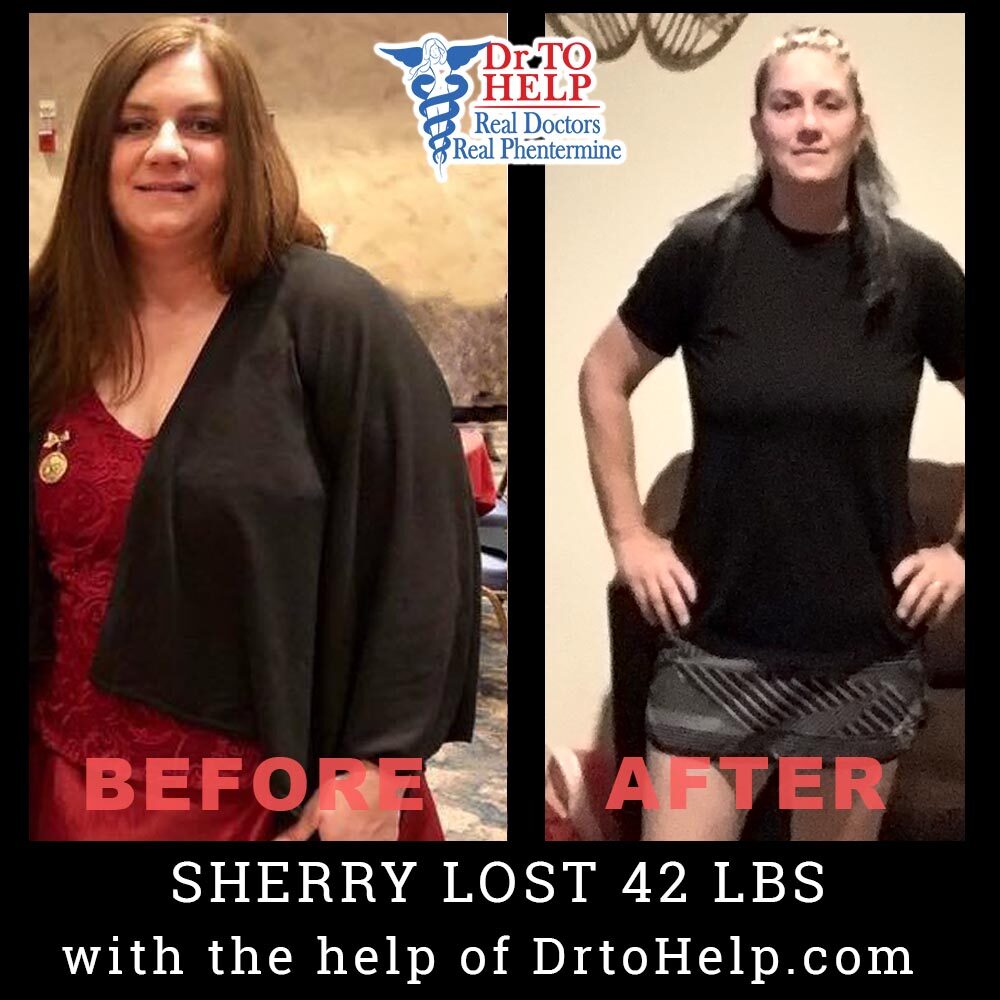 sherry-c-before-after_add10b7d-6923-4f40-9893-18d5e3767ff7-5294053