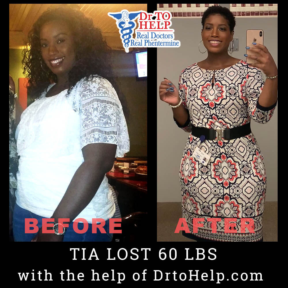 tia-b-before-after_fed6c7ef-5a6b-4193-8a01-8a1fc7eacc5f-5955279
