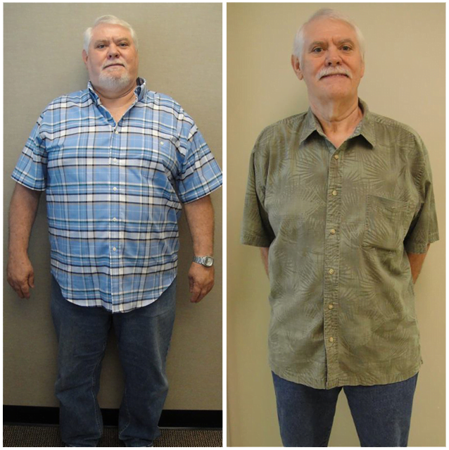 beforeafter-template_11-5729604