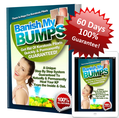 keratosis-pilaris-remedy-program-ebook-and-reader-guarantee-r-7220874