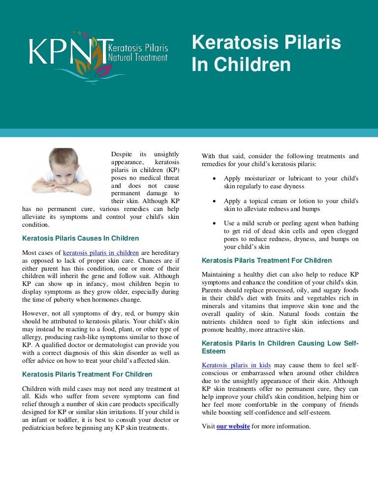 keratosispilarisinchildren-150127010021-conversion-gate02-thumbnail-4-7066460