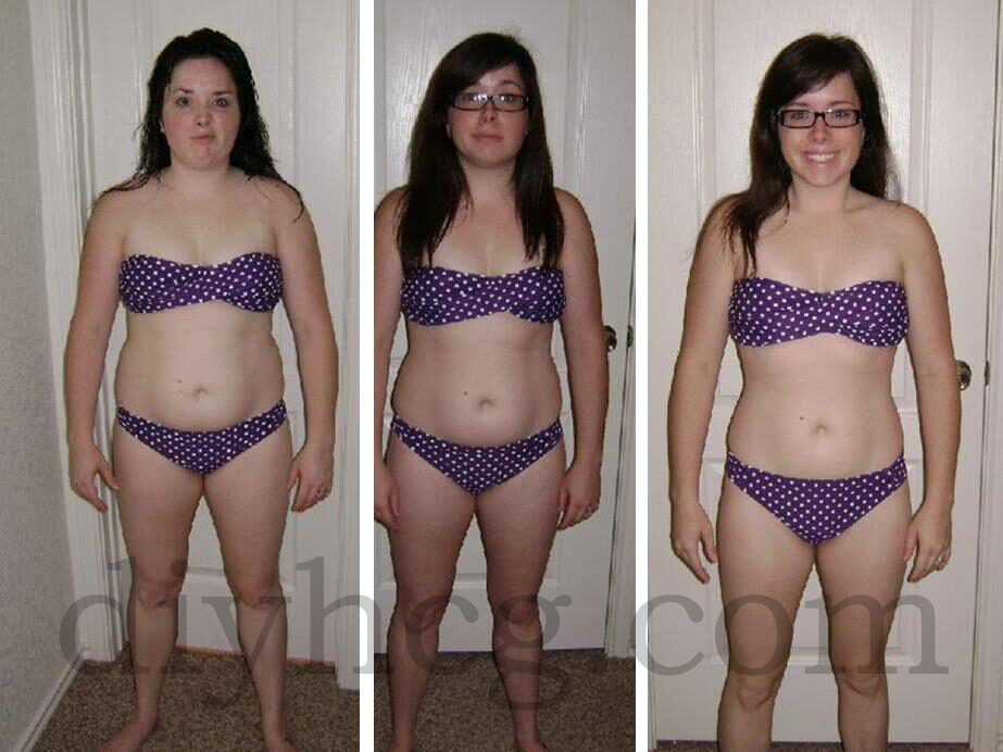 meg-hcg-before-and-after-photos-sequence-6446601