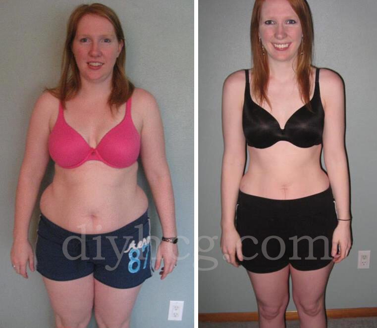 rebecca-hcg-before-and-after-photos-front-7659974