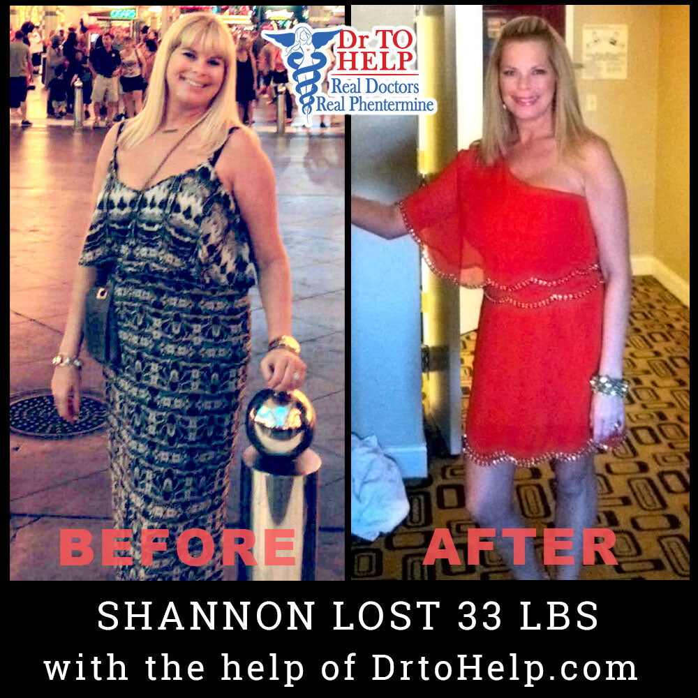 shannon-ts-before-after_d4d13247-c11a-4ec5-b5e0-65b36c294926-8258816