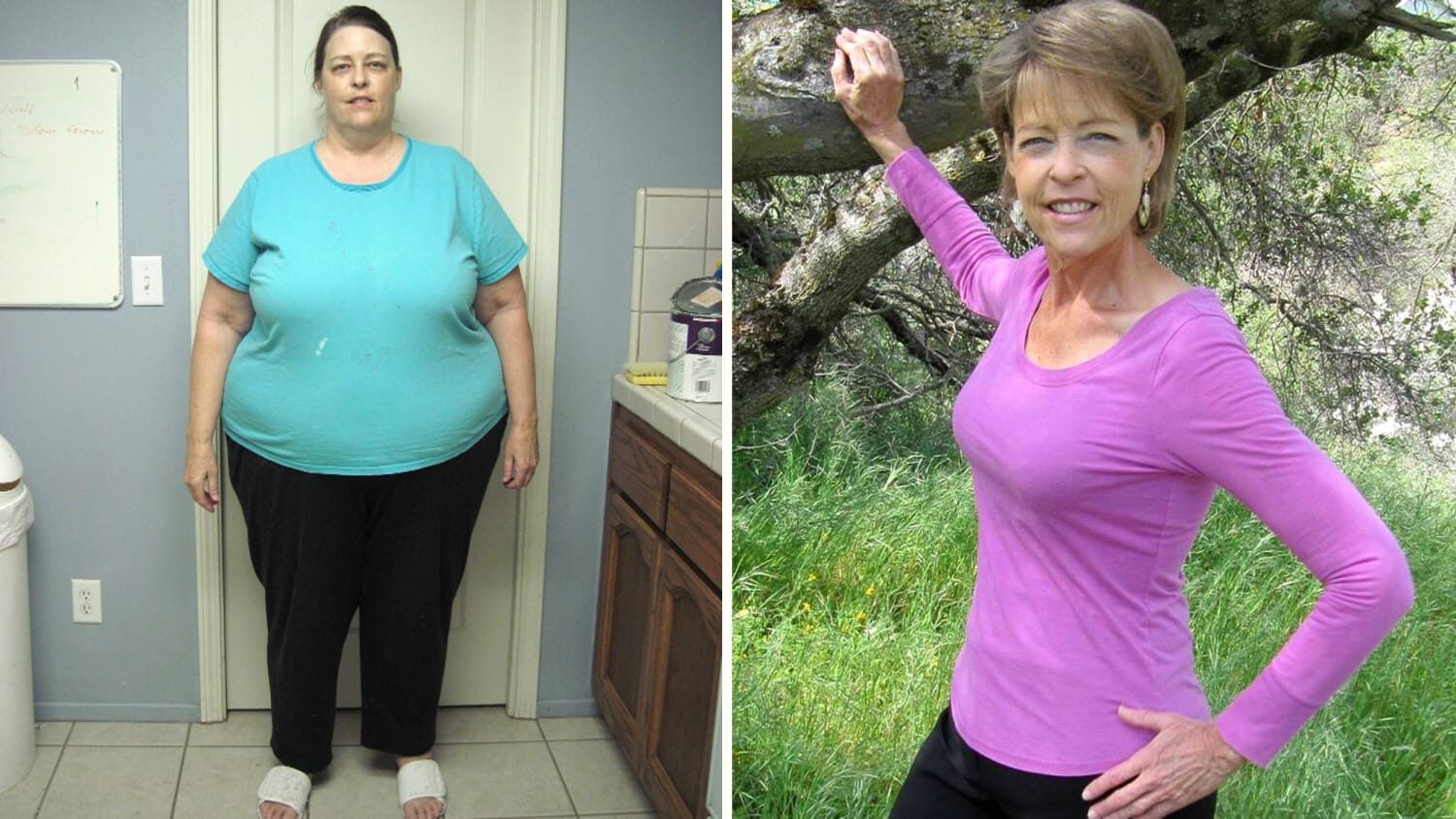 weightloss-before-after-split-tease-today-160712_80b4ae1145c5c9be6df3927f860f5007-1461503