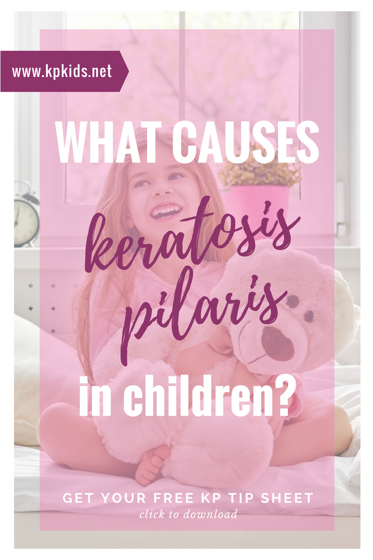 what-causes-keratosis-pilaris-children-kids-1384021