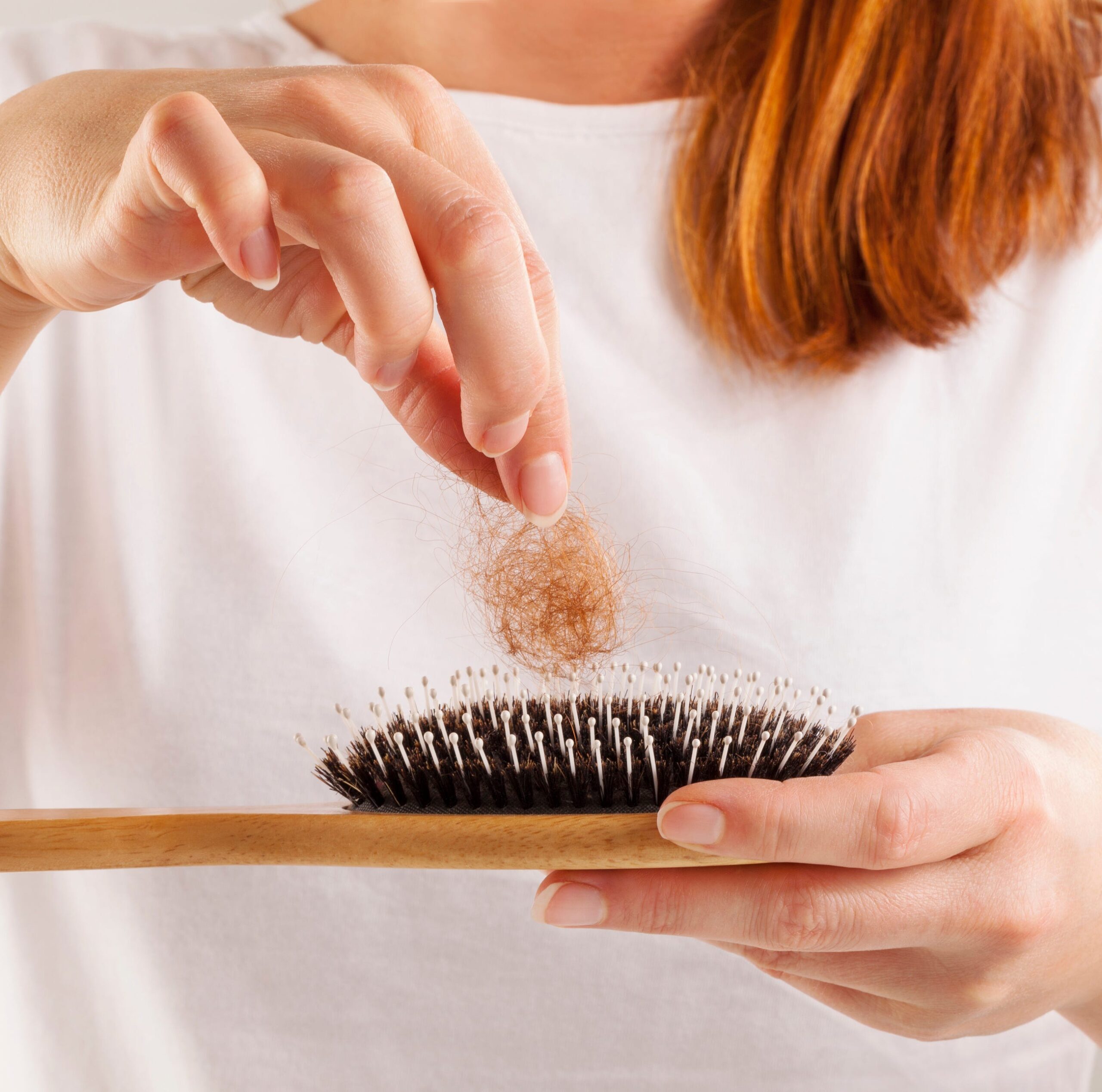 womens-hair-loss-royalty-free-image-896039574-1540415342-8938200